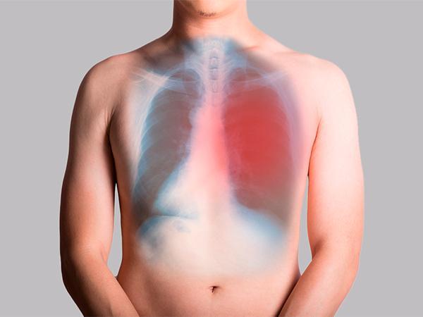 Asbestosis and Bronchiectasis Can Be Hidden and Can Be Improved Without Drugs